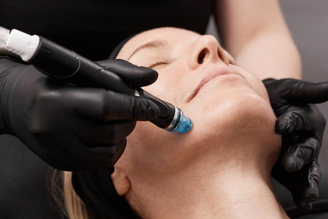 <p>Tiefenreinigung<br/>mit Glow-Effekt: <em><br/></em><em>HydraFacial</em></p>
